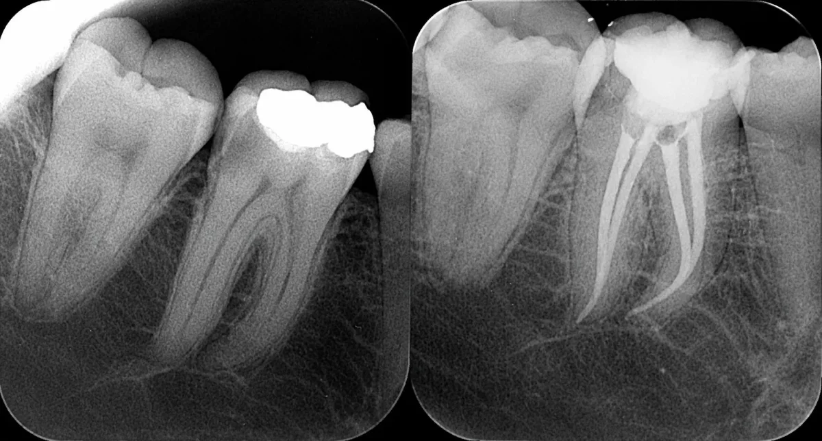 Endodontics